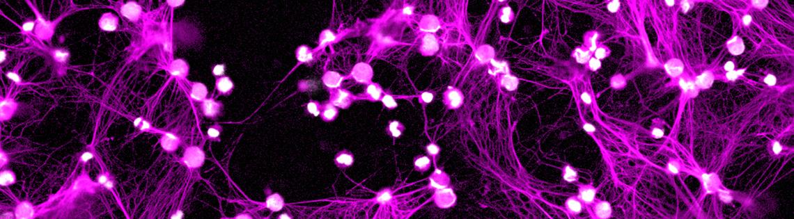 Purple web-like structures called NETS on a black background