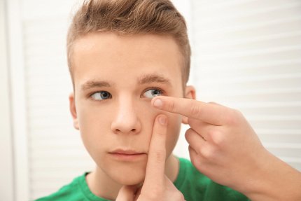 A teen inserting a contact lens