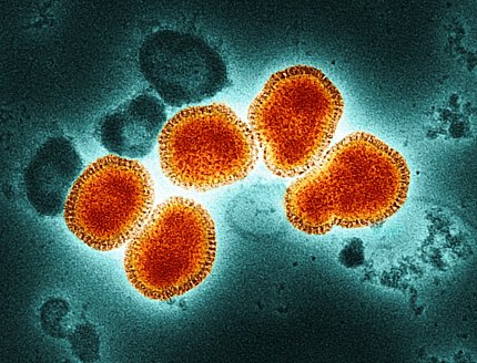 Colorized transmission electron micrograph of influenza A virus particles isolated from a patient sample and then propagated in cell culture.