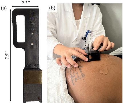Split image; the left side shows the black biosensor against a white background with the dimensions shown along the long side. On the right side, a person in a white coat demonstrates placement of the biosensor on a pregnant patient's stomach.
