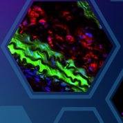 Artery sections of a mouse model