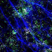 Blue streaks with green and white splotches on a black background