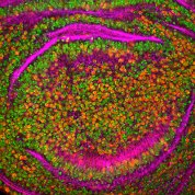 Green and purple and red dots inside a pink circle