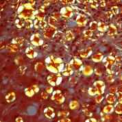 Globules showing an apple green birefringence