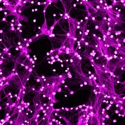 Purple web-like structures called NETS on a black background