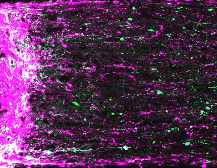 Colorful cells in mouse retina Colorful cells in mouse retina