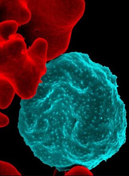 Colorized scanning electron micrograph of red blood cell infected with malaria parasites Colorized scanning electron micrograph of red blood cell infected with malaria parasites