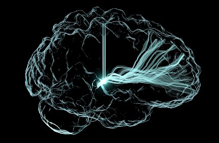 Andrew Janson’s “Light Me Up” image of brain